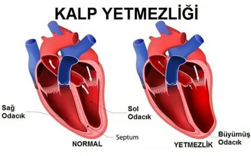 Kalp Yetmezliği İlaçları Nelerdir? ve Faydaları Nelerdir?
